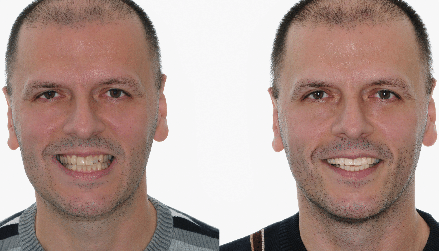 ia au cabinet dentaire