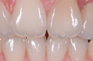 Maîtriser l’effet halo pour une stratification naturelle (1)