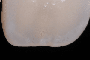 Maîtriser l’effet halo pour une stratification naturelle (2)