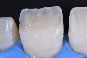 Maîtriser l’effet halo pour une stratification naturelle (5)