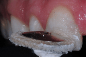 Maîtriser l’effet halo pour une stratification naturelle (7)